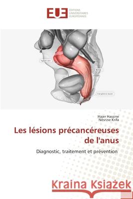 Les lésions précancéreuses de l'anus Hassine, Hajer, Krifa, Nesrine 9786139615070 Éditions universitaires européennes - książka