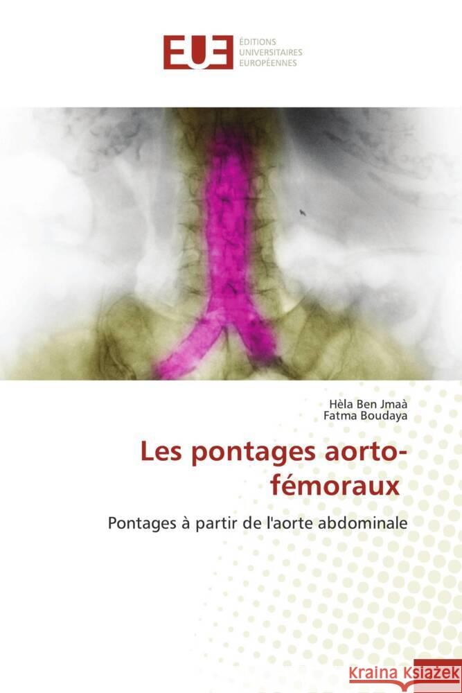 Les pontages aorto-f?moraux H?la Be Fatma Boudaya 9786206720638 Editions Universitaires Europeennes - książka