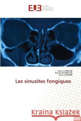 Les sinusites fongiques Dorra Chiboub Fatma Khanchel Anas Ammar 9786203442465 Editions Universitaires Europeennes - książka