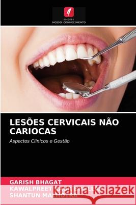 Lesões Cervicais Não Cariocas Garish Bhagat, Kawalpreet Kaur Bhullar, Shantun Malhotra 9786204079806 Edicoes Nosso Conhecimento - książka