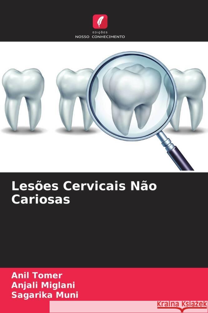 Les?es Cervicais N?o Cariosas Anil Tomer Anjali Miglani Sagarika Muni 9786208061975 Edicoes Nosso Conhecimento - książka