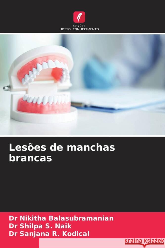 Lesões de manchas brancas Balasubramanian, Dr Nikitha, S. Naik, Dr Shilpa, R. Kodical, Dr Sanjana 9786208096120 Edições Nosso Conhecimento - książka