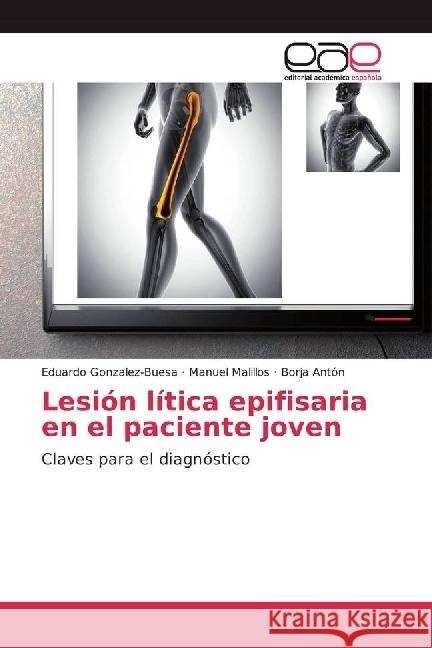 Lesión lítica epifisaria en el paciente joven : Claves para el diagnóstico Gonzalez-Buesa, Eduardo; Malillos, Manuel; Antón, Borja 9783841767868 Editorial Académica Española - książka