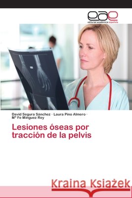 Lesiones óseas por tracción de la pelvis Segura Sánchez, David; Pino Almero, Laura; Mínguez Rey, Mª Fe 9786202252140 Editorial Académica Española - książka