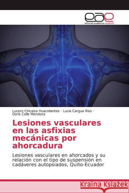 Lesiones vasculares en las asfixias mecánicas por ahorcadura : Lesiones vasculares en ahorcados y su relación con el tipo de suspensión en cadáveres autopsiados, Quito-Ecuador Chicaiza Huacoliantes, Lucero; Cargua Rios, Lucia; Calle Mendoza, Doris 9786200023056 Editorial Académica Española - książka