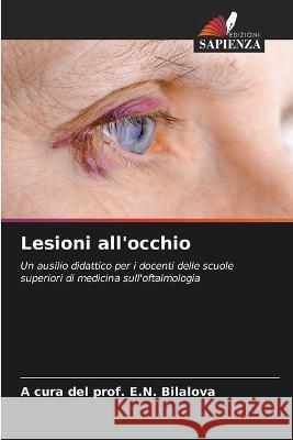 Lesioni all'occhio A Cura del Prof E N Bilalova   9786206105206 Edizioni Sapienza - książka