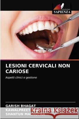 Lesioni Cervicali Non Cariose Garish Bhagat, Kawalpreet Kaur Bhullar, Shantun Malhotra 9786204079790 Edizioni Sapienza - książka