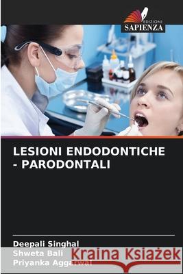 Lesioni Endodontiche - Parodontali Deepali Singhal, Shweta Bali, Priyanka Aggarwal 9786204142685 Edizioni Sapienza - książka