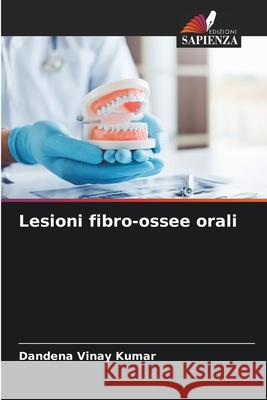 Lesioni fibro-ossee orali Vinay Kumar, Dandena 9786208777166 Edizioni Sapienza - książka