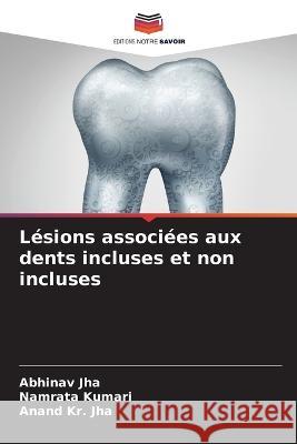 Lesions associees aux dents incluses et non incluses Abhinav Jha Namrata Kumari Anand Kr Jha 9786206128045 Editions Notre Savoir - książka