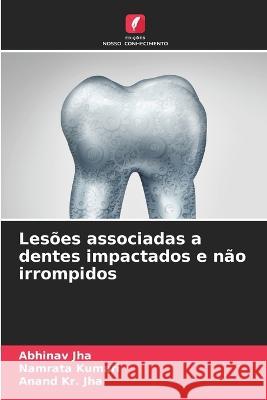 Lesoes associadas a dentes impactados e nao irrompidos Abhinav Jha Namrata Kumari Anand Kr Jha 9786206128069 Edicoes Nosso Conhecimento - książka