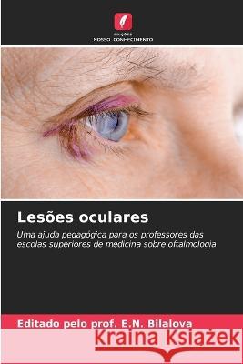 Lesoes oculares Editado Pelo Prof E N Bilalova   9786206105381 Edicoes Nosso Conhecimento - książka