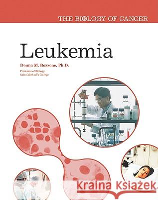 Leukemia Paul Butera 9780791088227 CHELSEA HOUSE PUBLISHERS - książka
