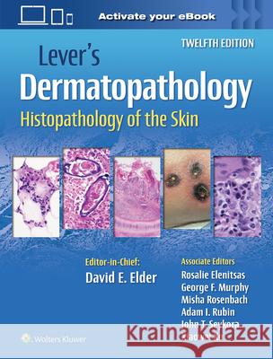 Lever's Dermatopathology: Histopathology of the Skin David E. Elder 9781975174491 LWW - książka