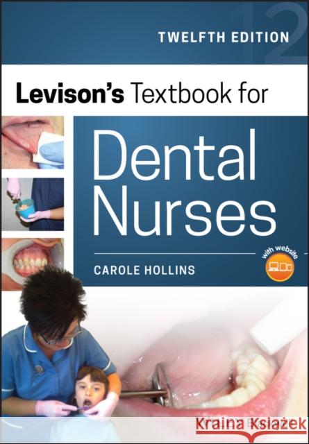 Levison's Textbook for Dental Nurses Carole Hollins 9781119401346 John Wiley and Sons Ltd - książka