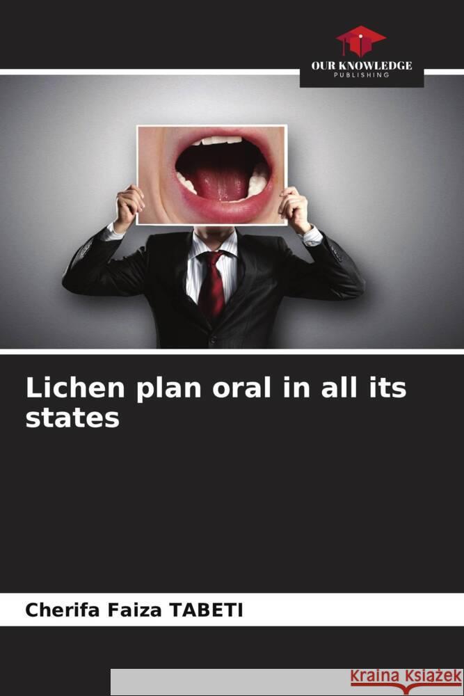Lichen plan oral in all its states Cherifa Faiza Tabeti 9786206522898 Our Knowledge Publishing - książka