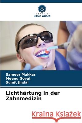 Lichthärtung in der Zahnmedizin Makkar, Sameer, Goyal, Meenu, Jindal, Sumit 9786200822352 Verlag Unser Wissen - książka