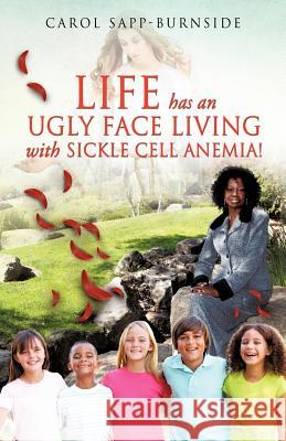 Life Has an Ugly Face Living with Sickle Cell Anemia! Carol Sapp-Burnside 9781625090898 Xulon Press - książka