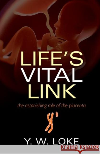 Life's Vital Link: The Astonishing Role of the Placenta Loke, Y. W. 9780199694525 Oxford University Press, USA - książka