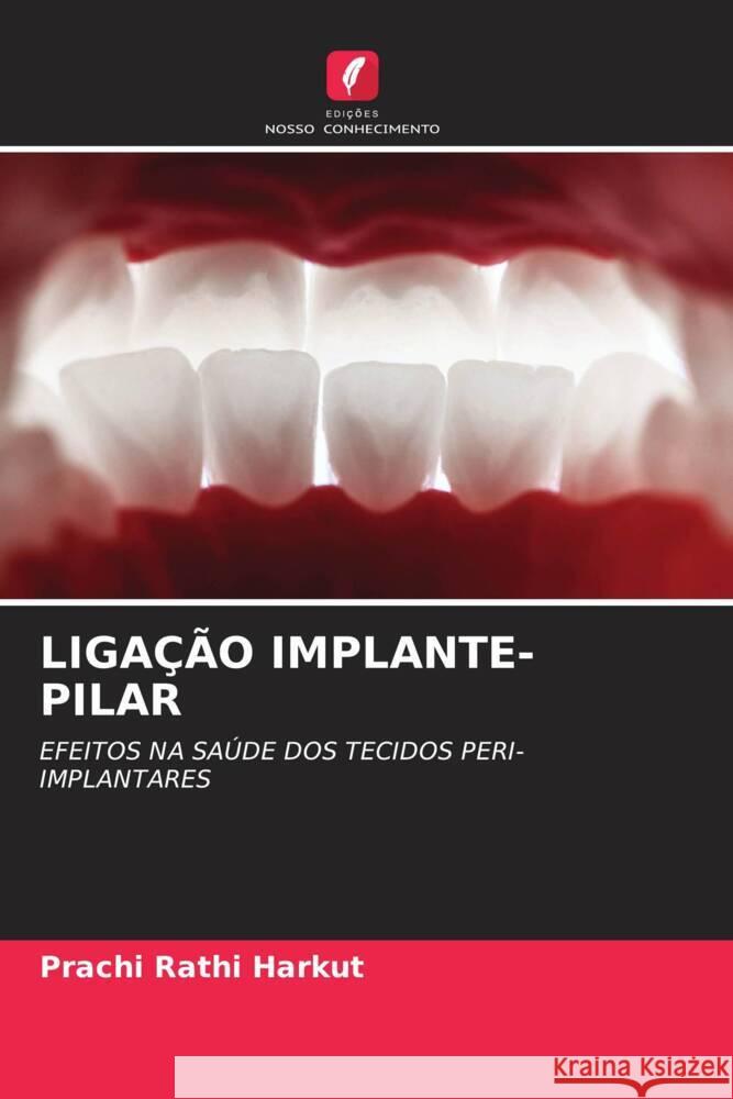 LIGAÇÃO IMPLANTE-PILAR Rathi Harkut, Prachi 9786208174316 _ CRC Press - książka