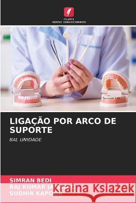 Liga??o Por Arco de Suporte Simran Bedi Raj Kumar Jaiswal Sudhir Kapoor 9786205599273 Edicoes Nosso Conhecimento - książka