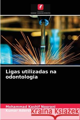 Ligas utilizadas na odontologia Mohammad Kashif Noorani, Kumar Adarsh 9786203228342 Edicoes Nosso Conhecimento - książka