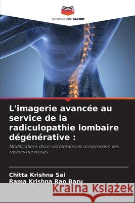 L'imagerie avancée au service de la radiculopathie lombaire dégénérative : Sai, Chitta Krishna, Baru, Rama Krishna Rao 9786208657352 Editions Notre Savoir - książka