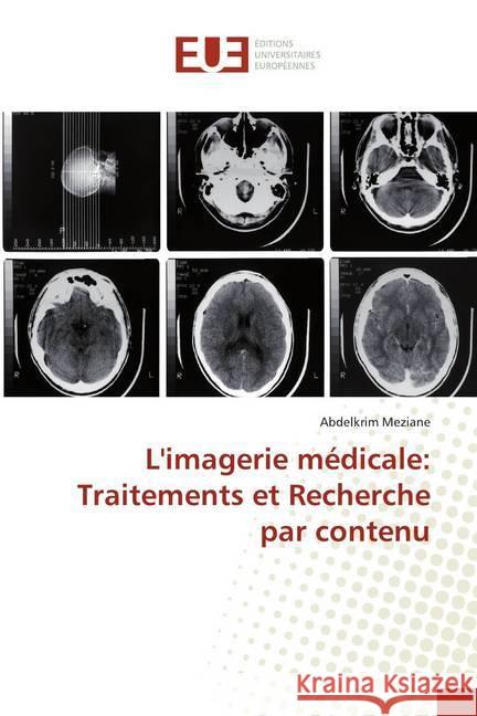 L'imagerie médicale: Traitements et Recherche par contenu Meziane, Abdelkrim 9783841674388 Éditions universitaires européennes - książka