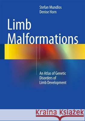 Limb Malformations: An Atlas of Genetic Disorders of Limb Development Mundlos, Stefan 9783540959274 Springer, Berlin - książka