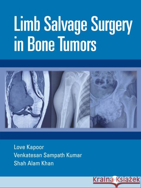 Limb Salvage Surgery in Bone Tumors Shah Alam Khan 9780367421304 Taylor & Francis Ltd - książka