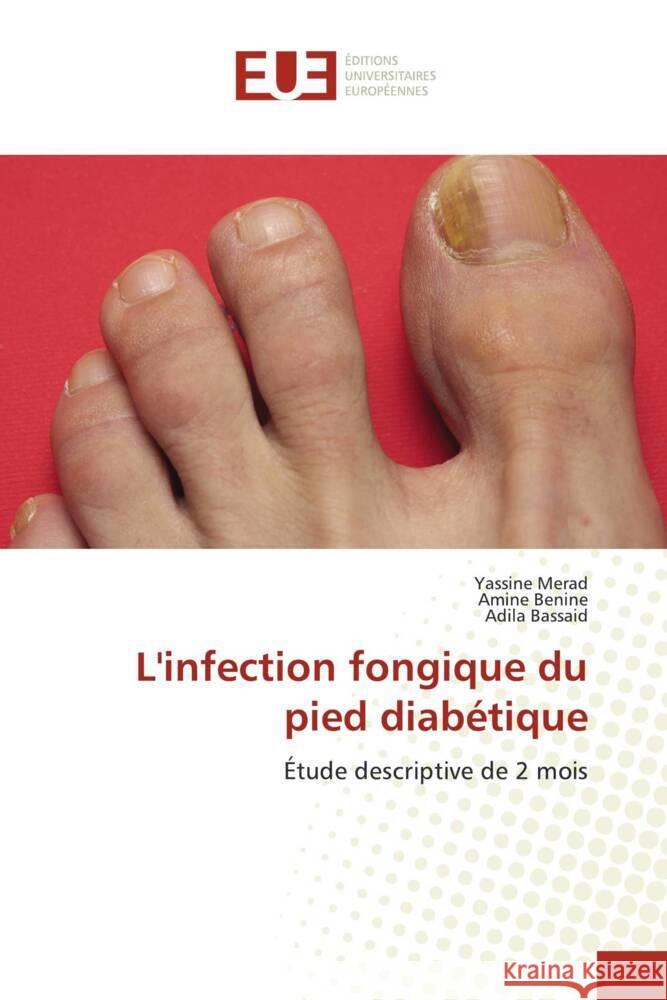 L'infection fongique du pied diabétique Merad, Yassine, Benine, Amine, Bassaid, Adila 9786203460827 Éditions universitaires européennes - książka