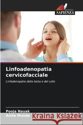 Linfoadenopatia cervicofacciale Nayak, Pooja, Munde, Anita 9786203780208 Edizioni Sapienza - książka