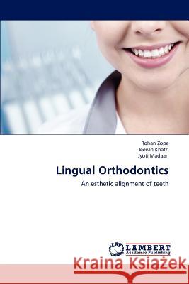 Lingual Orthodontics Rohan Zope Jeevan Khatri Jyoti Madaan 9783659206658 LAP Lambert Academic Publishing - książka