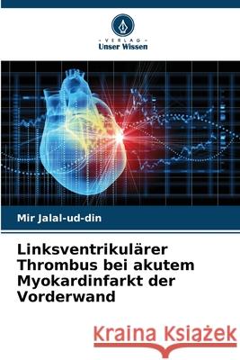Linksventrikulärer Thrombus bei akutem Myokardinfarkt der Vorderwand Jalal-ud-din, Mir 9786136285719 Verlag Unser Wissen - książka