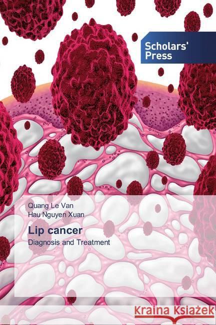 Lip cancer : Diagnosis and Treatment Le Van, Quang; Nguyen Xuan, Hau 9786138826996 Scholar's Press - książka