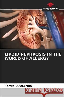 Lipoid Nephrosis in the World of Allergy Hamza Boucenna 9786207522590 Our Knowledge Publishing - książka