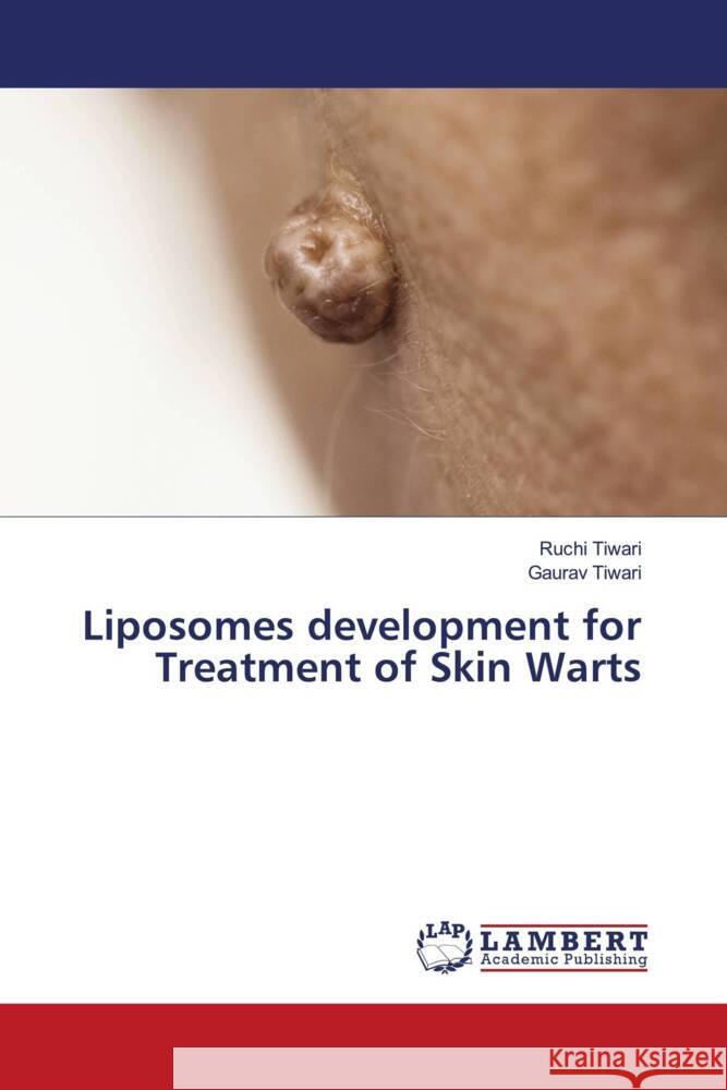 Liposomes development for Treatment of Skin Warts Tiwari, Ruchi, Tiwari, Gaurav 9786204202402 LAP Lambert Academic Publishing - książka