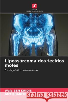 Lipossarcoma dos tecidos moles Wala Be Afef Khanfir 9786209459634 Edicoes Nosso Conhecimento - książka