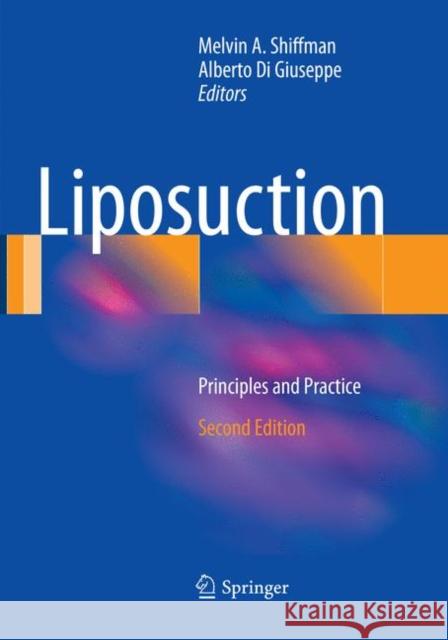 Liposuction: Principles and Practice Shiffman, Melvin a. 9783662569627 Springer - książka