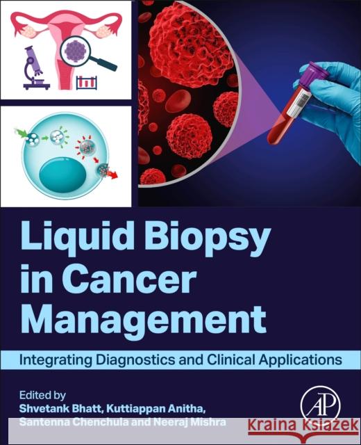 Liquid biopsy in Cancer Management: Integrating Diagnostics and Clinical Applications  9780443274961 Academic Press - książka