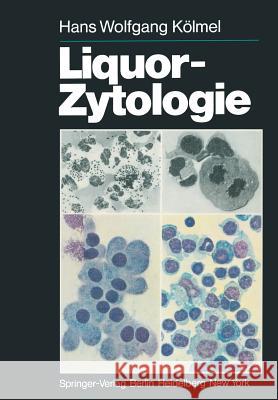 Liquor-Zytologie H. W. K J. Sayk 9783642964596 Springer - książka