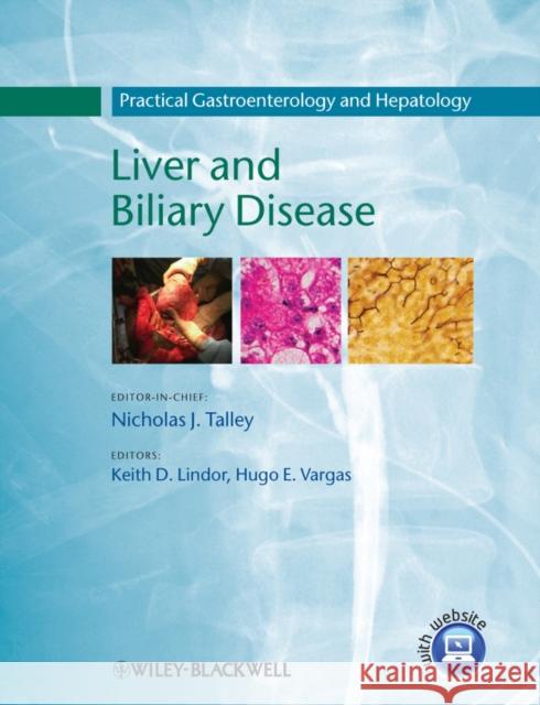 Liver and Biliary Disease: Practical Gastroenterology and Hepatology Talley, Nicholas J. 9781405182751 Wiley-Blackwell - książka