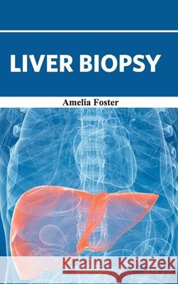 Liver Biopsy Amelia Foster 9781632422569 Foster Academics - książka