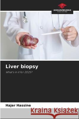 Liver biopsy Hassine, Hajer 9786209422720 Our Knowledge Publishing - książka