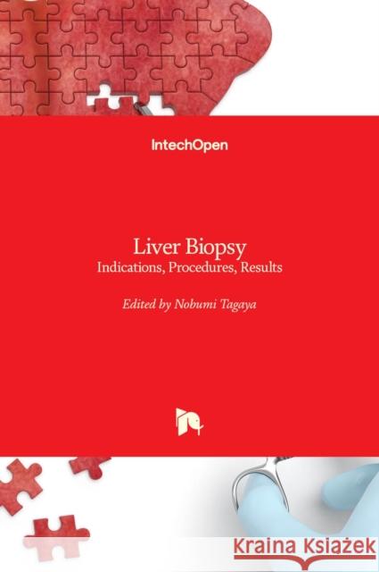 Liver Biopsy: Indications, Procedures, Results Nobumi Tagaya 9789535108535 Intechopen - książka