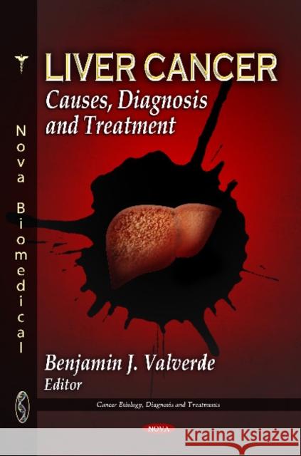 Liver Cancer: Causes, Diagnosis & Treatment Benjamin J Benjamin J Valverde 9781612091150 Nova Science Publishers Inc - książka