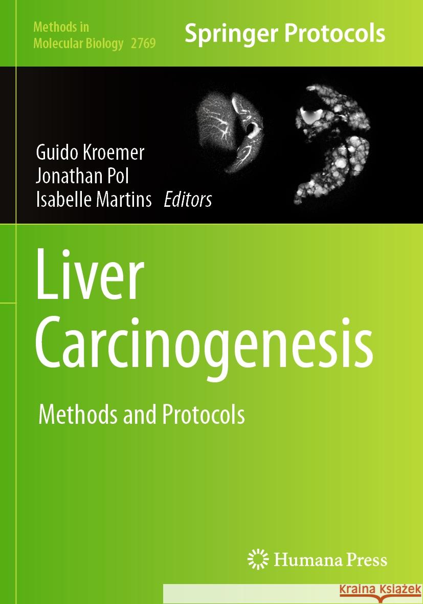 Liver Carcinogenesis: Methods and Protocols Guido Kroemer, Jonathan Pol, Isabelle Martins 9781071636961 Springer-Verlag New York Inc. - książka