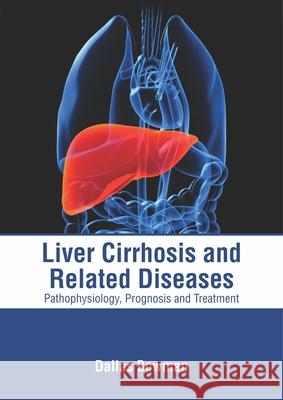 Liver Cirrhosis and Related Diseases: Pathophysiology, Prognosis and Treatment Dallas Bowman 9781632416377 Hayle Medical - książka
