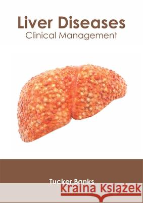 Liver Diseases: Clinical Management Tucker Banks 9781632426833 Foster Academics - książka