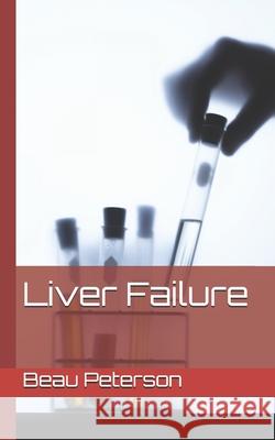 Liver Failure Beau Kent Peterson 9781677241576 Independently Published - książka